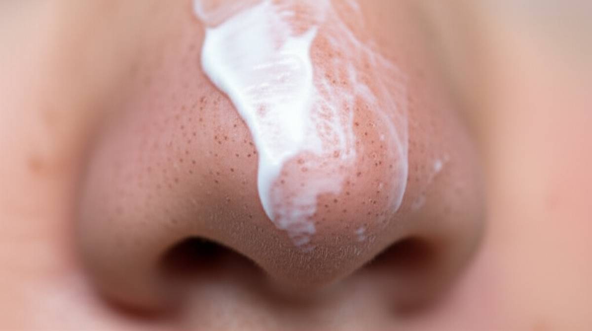 از بین بردن جوش سر سیاه بینی با خمیردندان