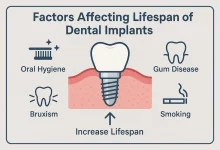 عوامل کلیدی موثر بر طول عمر ایمپلنت دندان چیست و به چه صورت می شود آن را افزایش داد؟