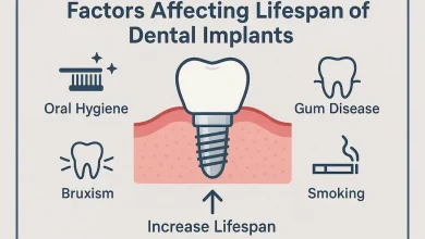 عوامل کلیدی موثر بر طول عمر ایمپلنت دندان چیست و به چه صورت می شود آن را افزایش داد؟