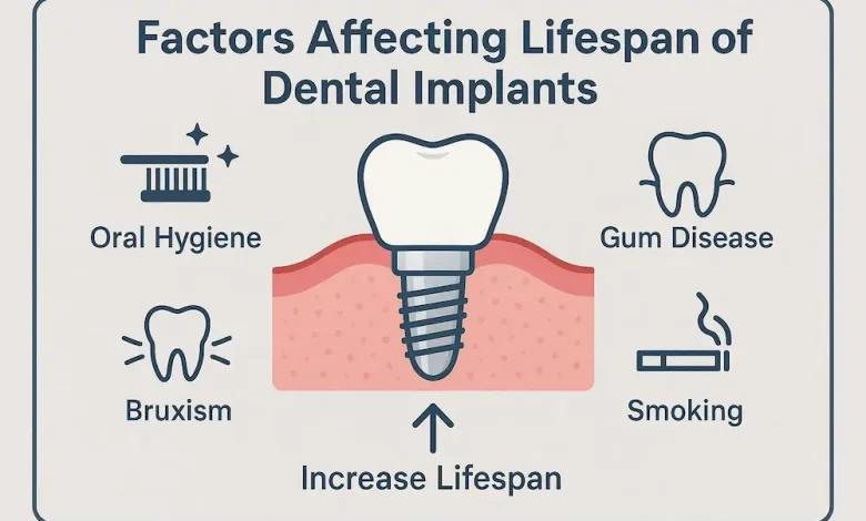 عوامل کلیدی موثر بر طول عمر ایمپلنت دندان چیست و به چه صورت می شود آن را افزایش داد؟